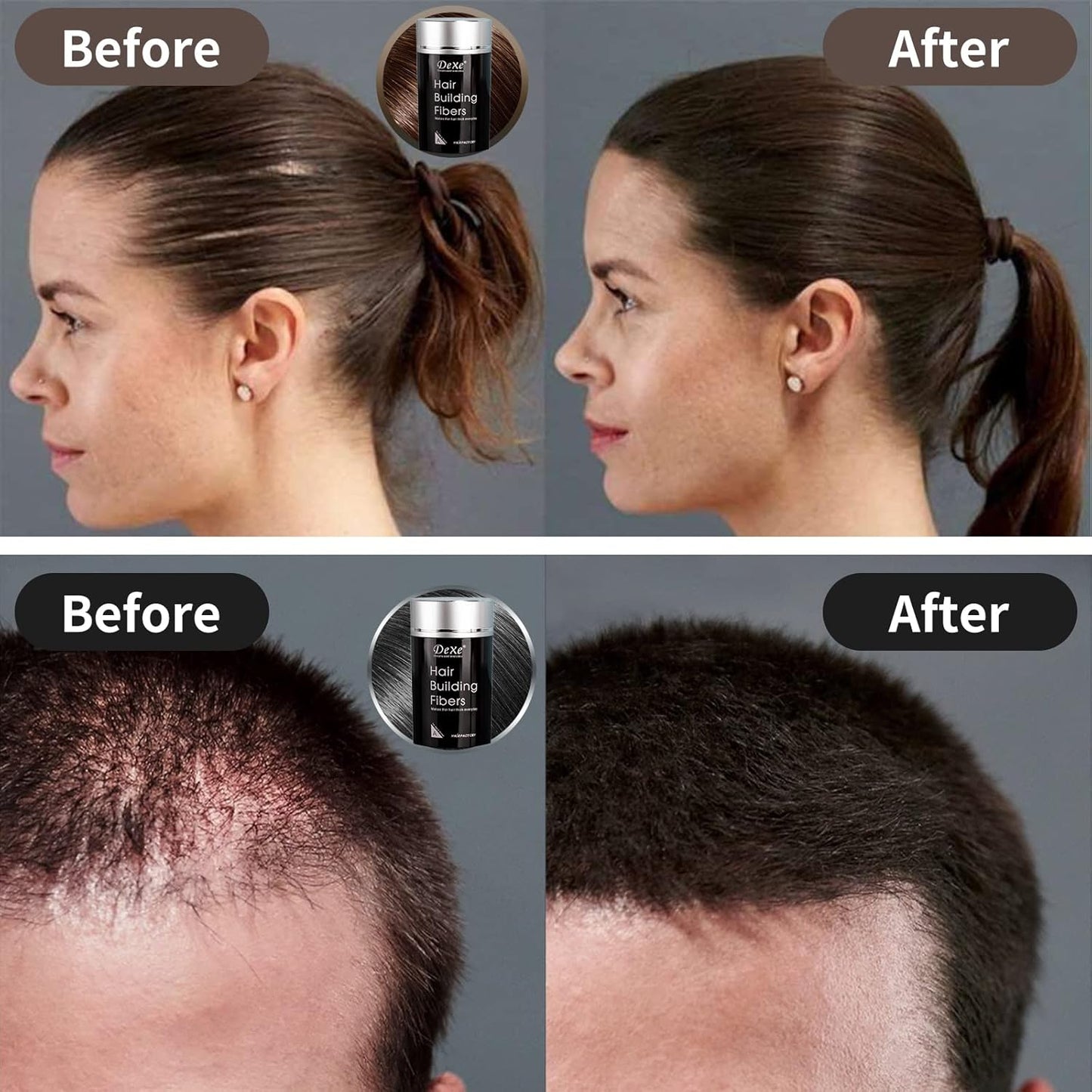 Hair Fibers for Thinning Hair