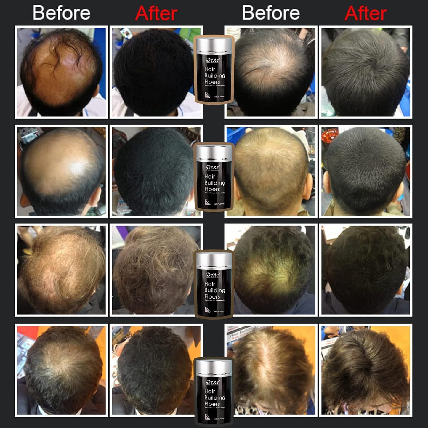 Hair Fibers for Thinning Hair