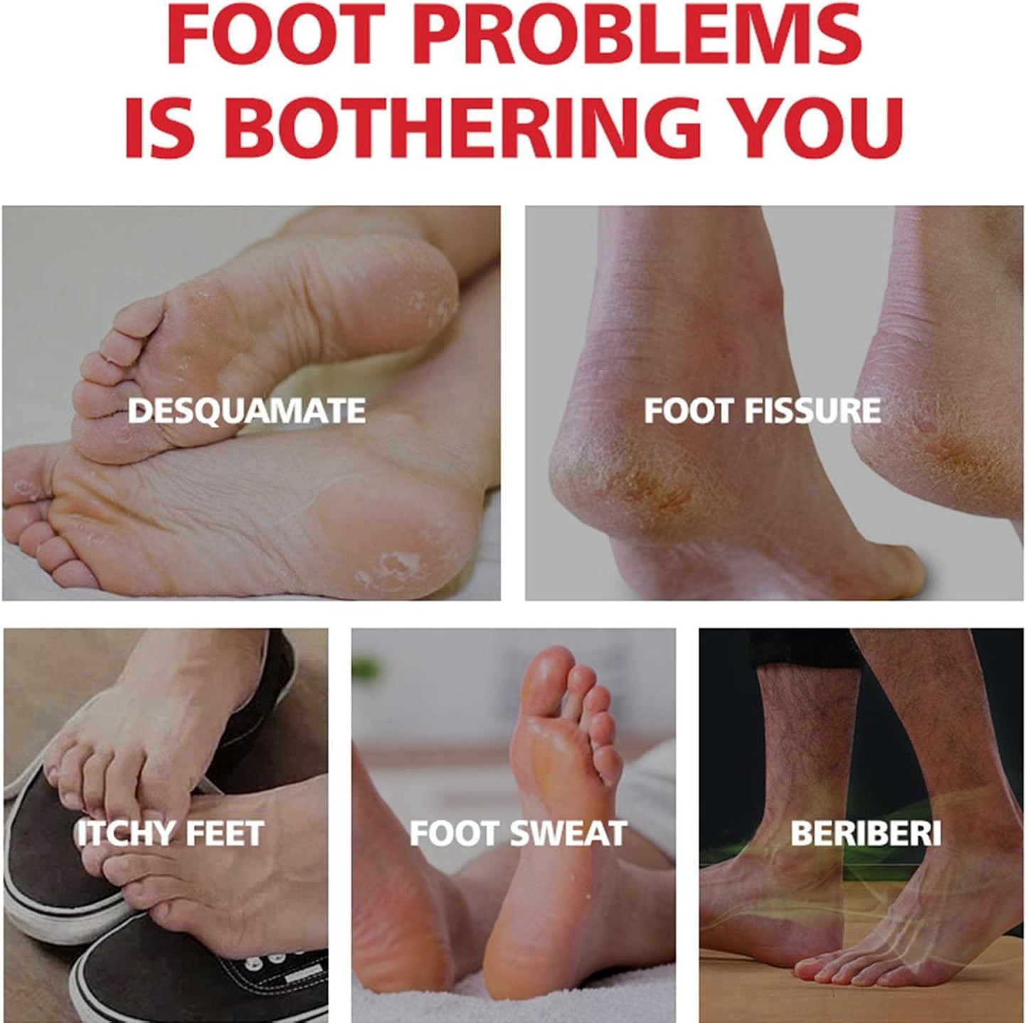 Foot Cream for Cracked Heels