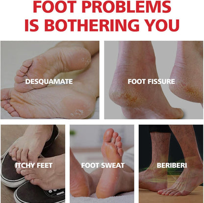 Foot Cream for Cracked Heels