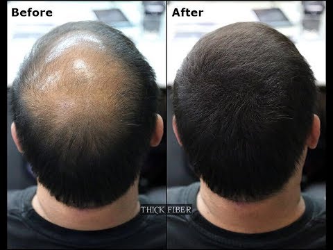 Dexe Hair Building Fibers Regrowth Hair